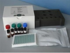 人类白细胞抗原b27(hla-b27)elisa试剂盒_试剂